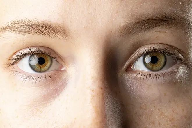 TraumaSolutions Close-up of a person's face showing light-colored eyes, brown eyebrows, and some freckles on the skin—a thoughtful expression that might resonate with those exploring deep processing or brainspotting for clinicians working with trauma.